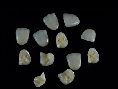 Kijan pou w chwazi pi bon lakòl dantè pou kouwòn yo: yon dènye gid