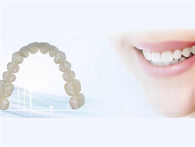 Dental Lab Outsourcing: Avantaj, Dezavantaj, ak Konsiderasyon kle