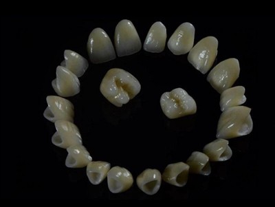 Dental Lab Zirconia Crowns: Kalite, Pwosesis, ak sa pou chèche pou yon laboratwa