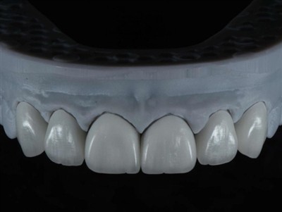 Ki jan yo konfye teknisyen laboratwa dantè travay lòt bò dlo: yon gid konplè