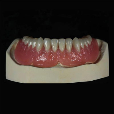 Detachable Acrylic Full Denture